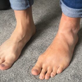 Foot prosthetic